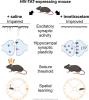 Levetiracetam Prevents Neurophysiological Changes and Preserves Cognitive Function in the Human Immunodeficiency Virus (HIV)-1 Transactivator of Transcription Transgenic Mouse Model of HIV-Associated Neurocognitive Disorder